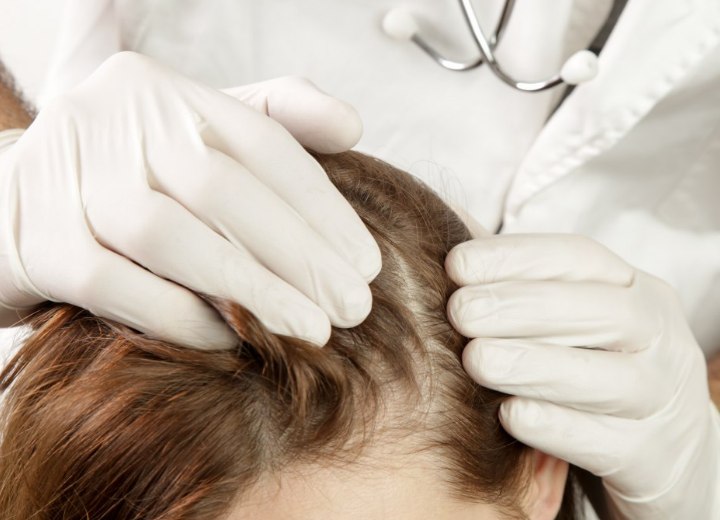 Dokter die alopecia onderzoekt